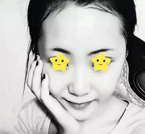 做綜合鼻，上海首爾麗格安建榮鼻綜合真人案例照片