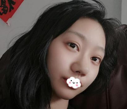 上海伊美爾港華做的3w的鼻子，你們說值不值