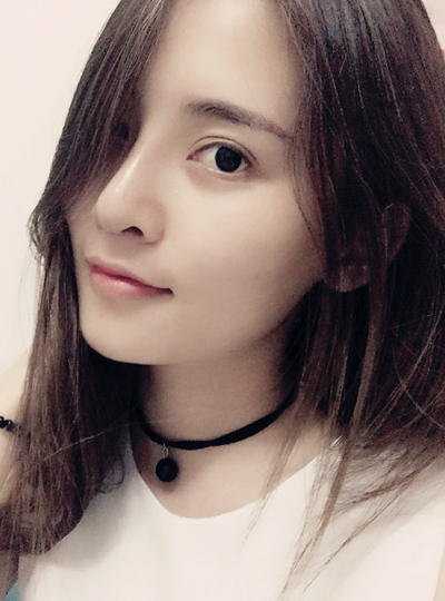 深圳微姿醫(yī)療美容門(mén)診部康壯為做鼻綜合案例效果分享