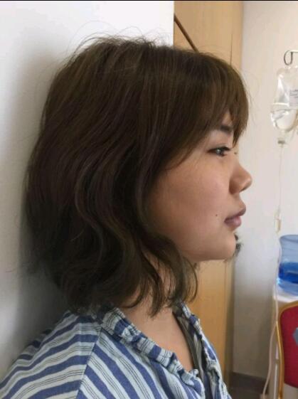 上海美萊醫(yī)療美容門(mén)診部做鼻綜合手術(shù)前