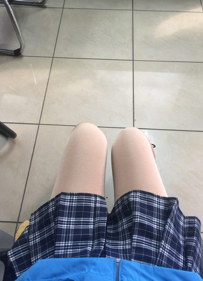 蘇州圣愛醫(yī)院醫(yī)療美容科做大腿吸脂手術(shù)后的恢復情況