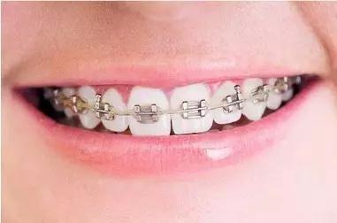 常州瀚景口腔牙齒拋光怎么樣？牙齒拋光有什么作用？