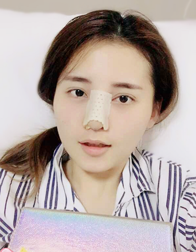 深圳微姿醫(yī)療美容門(mén)診部康壯為做鼻綜合案例效果分享