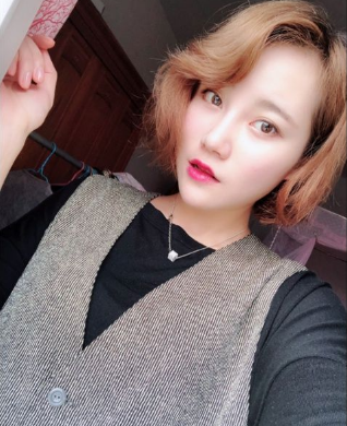 上海時光整形外科醫(yī)院做鼻綜合手術后的第一個月